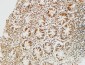 PKM2 Polyclonal Antibody